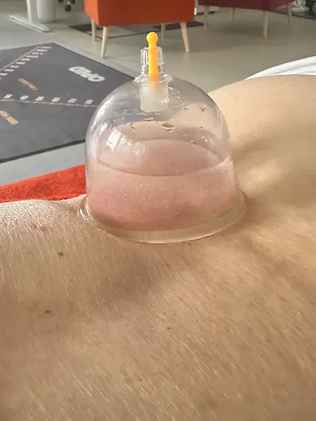 Wasserschröpfen